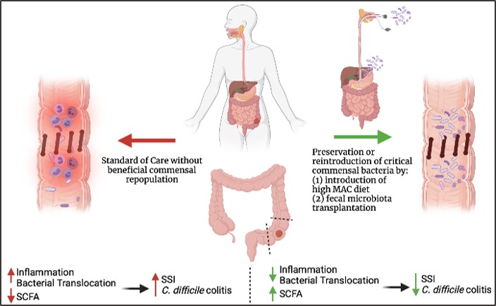 Microbiome in Surgical Outcomes